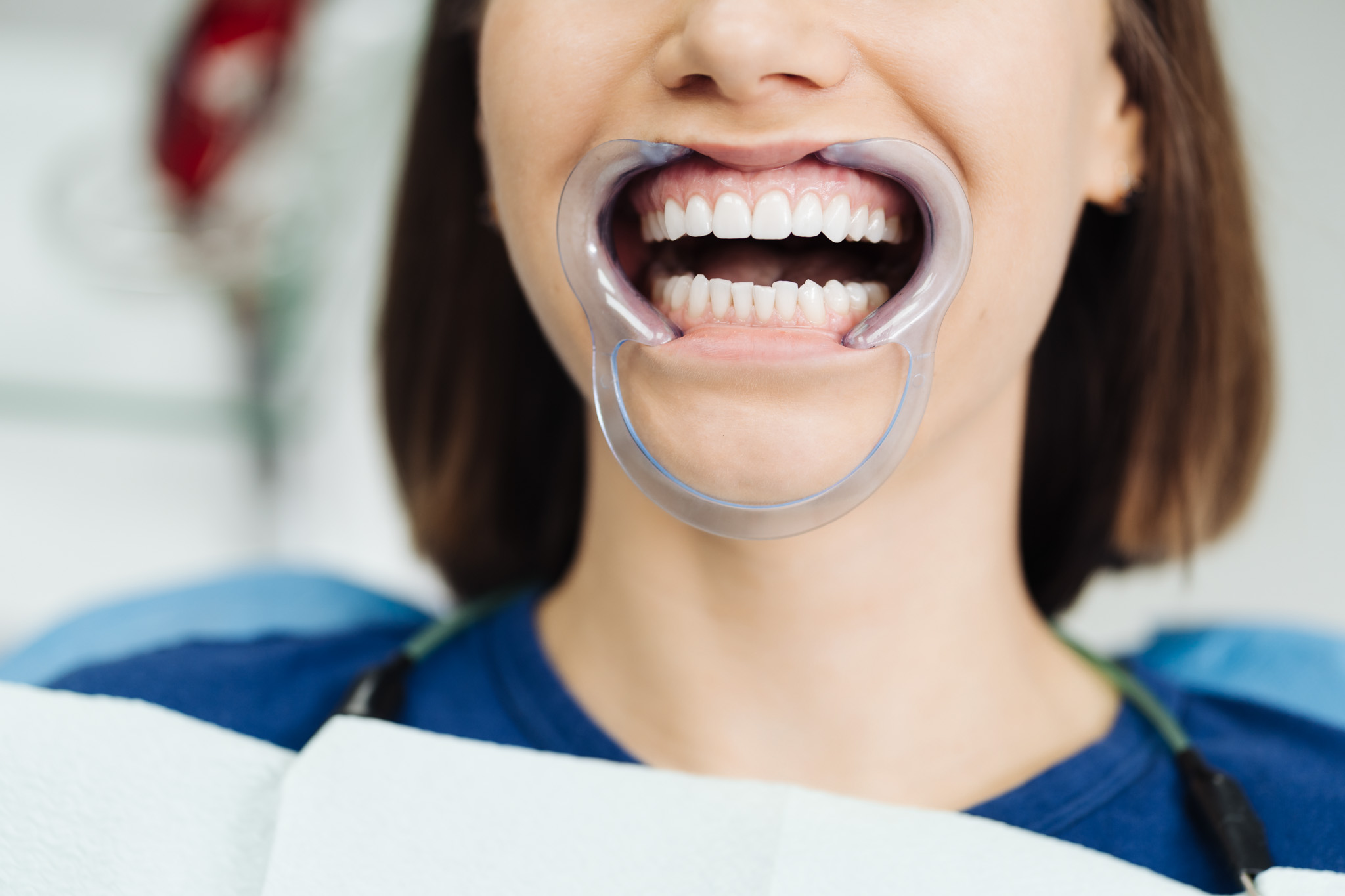 Dentist checking and selecting color of young woman’s teeth